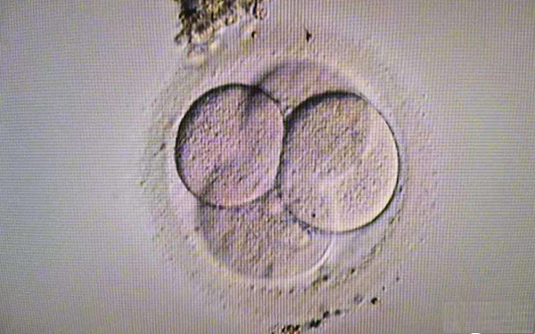 取卵后胚胎移植条件为胚胎质量过关